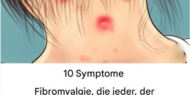 10 Symptome von Fibromyalgie, die jeder mit Muskelschmerzen lesen sollte