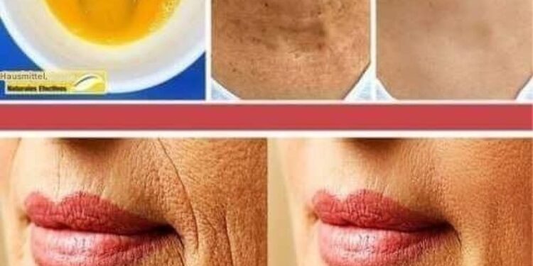 Ich habe es getan und niemand hat es geglaubt: Diese Creme hilft Ihnen in wenigen Tagen bei Falten und Hautunreinheiten