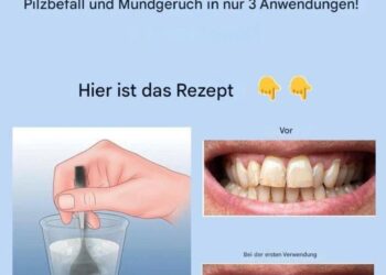 Entfernen Sie Zahnstein und bleichen Sie Ihre Zähne mit diesem einfachen Rezept.