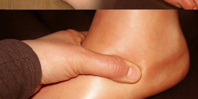 Geschwollene Hände und Füße schnell loswerden