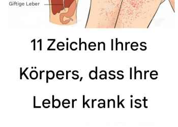 Anzeichen dafür, dass Ihre Leber krank ist
