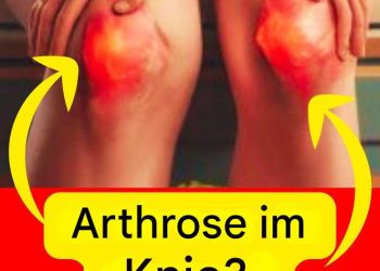 Entlasten Sie Ihre Knie sanft: 10 Tipps, die von Gesundheitsexperten validiert wurden