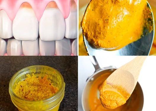 Warum Kurkuma fantastisch für die Mundgesundheit und Hygiene ist