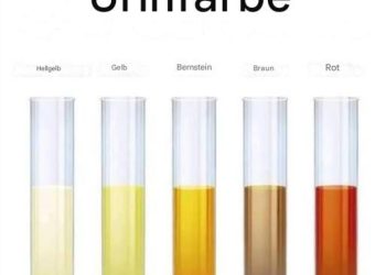 Finden Sie heraus, was Ihnen schaden könnte!