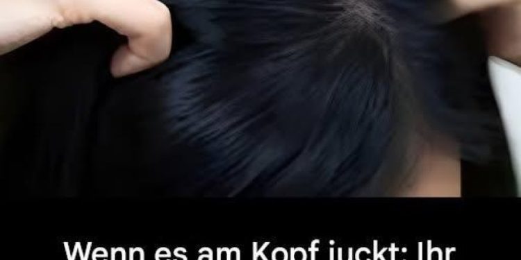 Juckt Ihre Kopfhaut? Hier sind die Hauptursachen.