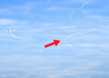 Glaskörpertrübungen verstehen: Ursachen, Symptome und hilfreiche Tipps